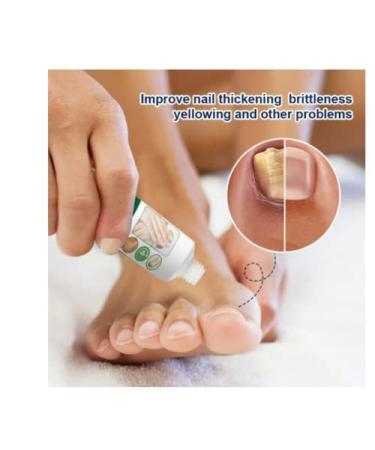 Moisturizing Antipruritic Ointment for Dry Skin Peeling on Hands and Feet - Buy Online on GoSupps.com