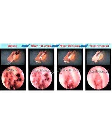 playhair Red Led Light Therapy Device -Cat Dog Horse. Pain Relief Hip Joint Mobility.and Inflammation Relief Advanced Pain Relief - Buy Online on GoSupps.com