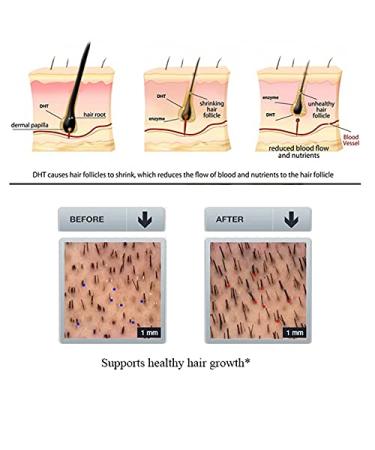 PURC Herbal Ginseng Shampoo | Hair Growth Treatment & Serum for Thicker Healthier Hair - Buy Online on GoSupps.com