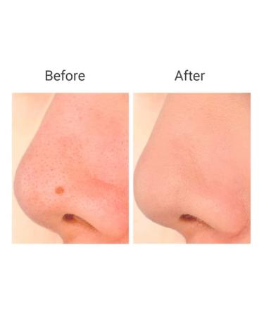 Snow Fox Skincare Instant Cloud Skin Brush | Ultra-Soft Vegan Makeup Brush for Flawless Application - Buy Online on GoSupps.com