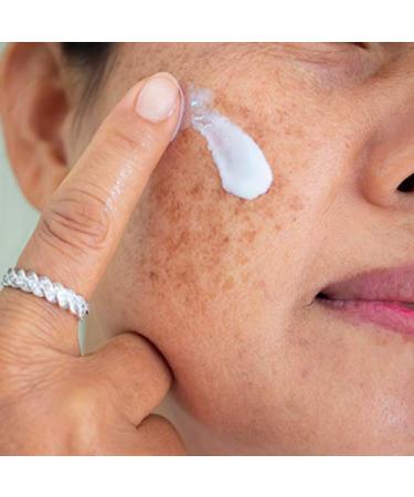 Skinuva Scar Cream (0.5 oz) + Skinuva Brite Hyperpigmentation Treatment (1 oz) | Advanced Scar Removal & Skin Brightening Cream with Growth Factors - Buy Online on GoSupps.com