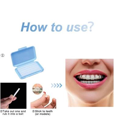Angzhili 10 Pack Dental Orthodontics Wax for Brace Wearers Gum Protection (Multi-Color) - Buy Online on GoSupps.com