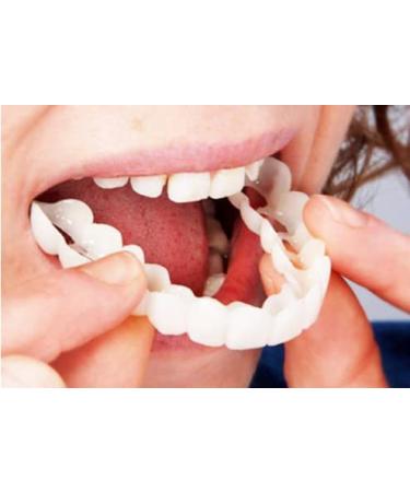 Losuya Instant Veneers Dentures Fake Teeth Smile Teeth Top Fake Teeth for Women and Men