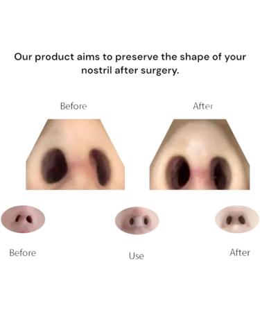 Premium Nostril Retainer For Rhinoplasty + Tape 2 Sizes in One Box (Size 7 & 8) Top-Grade Post-Surgery Nose Shaper Don t Risk Your Beauty Comfortable & Invisible Nose Retainer (( 7 & 8 )) - Buy Online on GoSupps.com