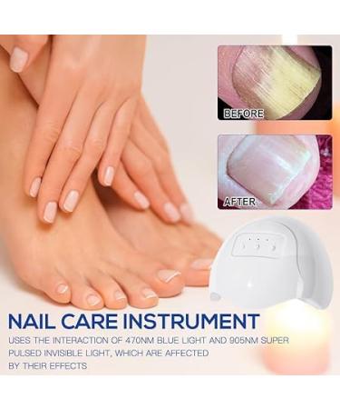 Furzero Purenail Laser Therapy Device | Effective Nail Fungus Treatment & Light Therapy for Healthy Nails - Buy Online on GoSupps.com