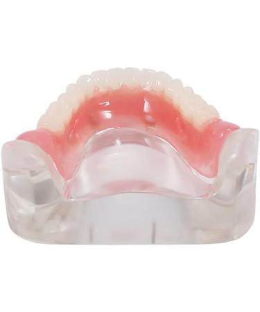 COMDS Dental Implant Model & Removable Dentures for Educational Use | 4 Nail Implant Demo Models - Buy Online on GoSupps.com