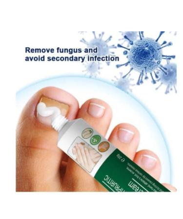 Moisturizing Antipruritic Ointment for Dry Skin Peeling on Hands and Feet - Buy Online on GoSupps.com