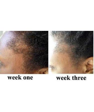 Sonik Performance PURE JAMAICAN BLACK CASTOR OIL 4oz 125ml - With FRAGRANCE - For Face Hair Body and Nails. Original 100% Pure Castor Beans Oil For Hair Eyelashes And Eyebrows HAIR GROWTH OIL - Buy Online on GoSupps.com