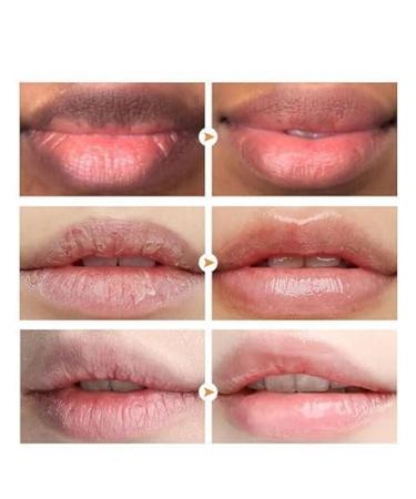 Lip Lightening for Dark Lips Turmeric Lip Balm for Smokers Lip Brightener for Smokers Dark Lip Lip Scrub for Dark Lips to Lighten Lip Exfoliator Scrub for Lip Softening & Hydration - Buy Online on GoSupps.com