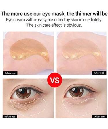 60 (30 pairs) Retinol Hyaluronic Acid Collagen Hydra-Gel Eye Pads/Patches Reduce Fine Lines and Wrinkles Dark Eyes Eye Bags Black Bags Crows Feet Smoother Fresher Looking Eyes and Skin - Buy Online on GoSupps.com