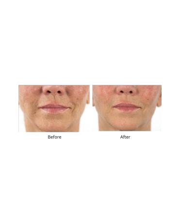 Dr. Sevinor s Combo Special 1oz.Facelift Solution Concentrated Serum Wakens Tired Looking Skin + Dr.Sevinor's Solution Gentle Exfoliating Cleanser Removes Make-up Residue Cleans Like No Other. - Buy Online on GoSupps.com