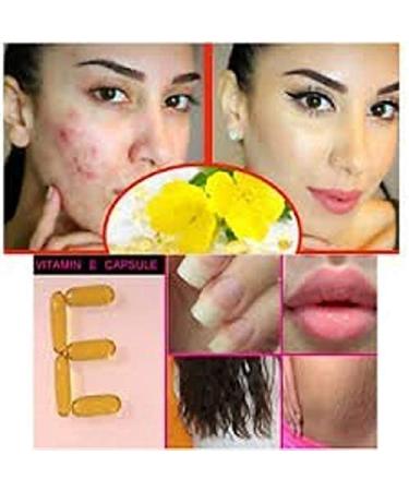 Evion Capsules 400mg Vitamin E for Glowing Face, Hair, Acne, Nails & Skin - 10 Count (Pack of 5) - Buy Online on GoSupps.com
