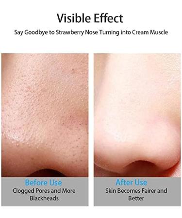 FEDRUI HD Visual Blackhead Remover Electric Pore Cleansing Facial Blackheads Suction Device Blackhead Extractor Tool with 6 LED Fill Lights for Home Bathroom - Buy Online on GoSupps.com