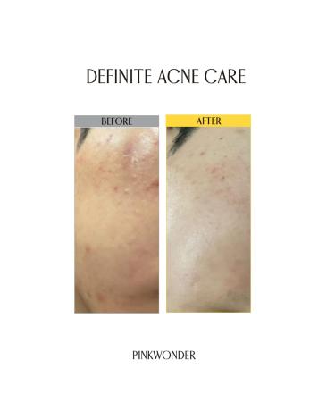 Tamanu Hero Cleanser 5.07oz | Acne & Oily Skin Face Wash | Salicylic Acid & Tamanu Oil | Soothing Korean Skincare for Sensitive Skin - Buy Online on GoSupps.com