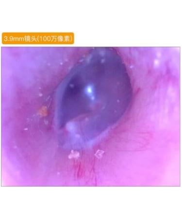 Yuidaaavzz Ear Wax Removal Tool Ear Cleansing Tool Set with 4.3 inches 3.9mm Ear Cleaning Camera and Soft Silicone Earwax Remover Tool (Color : Blue) (Blue) - Buy Online on GoSupps.com