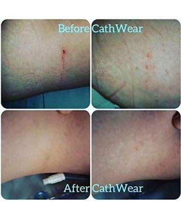 Cathwear Catheter Leg Bag Underwear | Medicare Approved Holder for Men & Women | Fits Foley Nephrostomy Suprapubic Biliary Catheters | 600ml Capacity | Black | Large (1 Pair - Buy Online on GoSupps.com