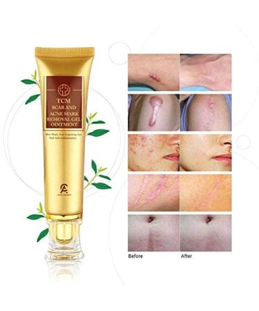 Scar Removal Cream for Old Scars & Stretch Marks Relief - Men & Women Face Skin Repair Gel - Buy Online on GoSupps.com