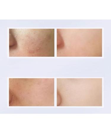 1PC Plift Face Toner Soothing Fine Lines and Redness 150ml - Buy Online on GoSupps.com