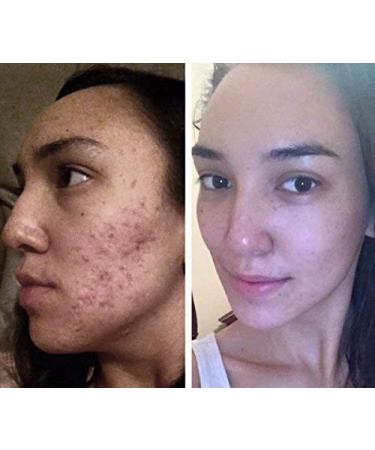 Alitura Clay Face Mask - Exfoliate, Cleanse, and Moisturize with Vitamin C & Pearl Powder - Hydrating Facial Mask for All Skin Types - Cruelty-Free (7.1 oz) - Buy Online on GoSupps.com