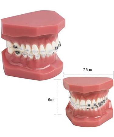 ERNZI Dental Template Orthodontic Model - Semi-Ceramic Half Mount for Accurate Oral Assessments | International Shipping Available - Buy Online on GoSupps.com