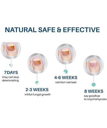 Nail Treatment Repair Toe Nail Repair Treatment Extra Strength Toenail Repair Solution Nail Renewal Liquid For Discoloration Nail & Toenails(10ML) - Buy Online on GoSupps.com