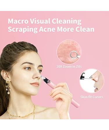 20x Magnification Blackhead Remover Tool with Camera & Light - Rechargeable Extractor for iPhone, iPad & Android - Buy Online on GoSupps.com