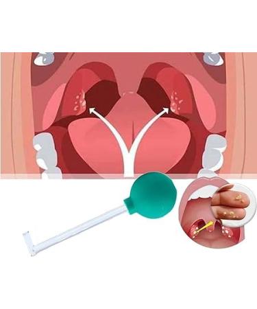 Remove almond stones tonsilenstein remover tonsilenstein removed for removing tonsil stones almond stones cupping glass effective mouth cleaning for a fresher breath (green)
