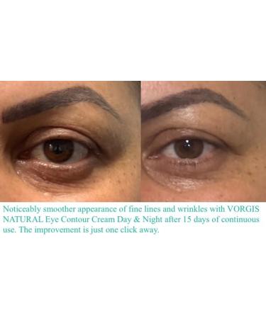 VORGIS NATURAL Night Regenerating Cream with Hyaluronic Acid - Buy Online on GoSupps.com