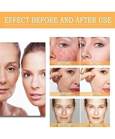 Glycolic Acid 7% Toner Glycolic Toning Solution 100ml*2 - Buy Online on GoSupps.com