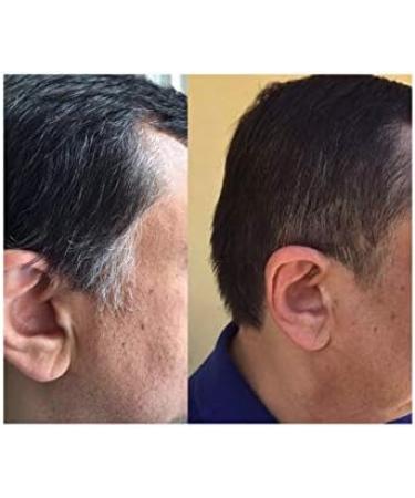 Hair Loss for Men - Gray Hair Reverse Complex - Natural Solution - Powerful Results zinc Hair Vitamins biotin Supplement paba biotin Supplements for Hair and Nails Gray Hair Vitamins 1B 60 Caps - Buy Online on GoSupps.com