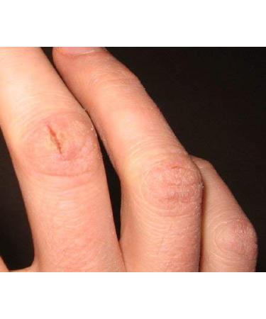 Nutroleum Non-Petroleum Skin Balm | All Natural Chemical-Free Water-Resistant Alternative to Petroleum Jelly | Vegan Personal Care (3 oz - Buy Online on GoSupps.com