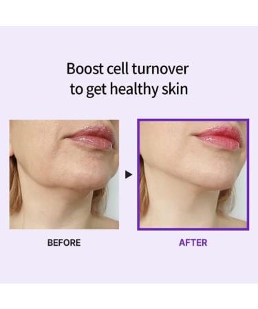  MEDI-PEEL Peptide 9 Volume and Tension Tox Cream 50 g - Buy Online on GoSupps.com