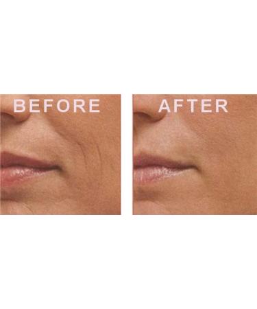 Galia MATRIXYL 3000 Peptide Serum + Hyaluronic Acid For Anti Aging + Anti Wrinkle Serum for Wrinkles Fine Lines Sun Spots Powerful Anti Aging Face Serum 30 ml - Buy Online on GoSupps.com