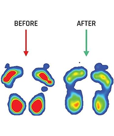 Buy Smou Comfort Shoe Insoles - Gel Inserts for Men & Women | Anti-Sweat Memory Foam | Ideal for Work Shoes | Great Cushioning (42-43 EU) - Buy Online on GoSupps.com