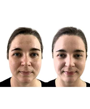 Dermaflage Waterproof Concealer Palette | 3 Medium Shades for Flawless Skin - International Shipping Available - Buy Online on GoSupps.com