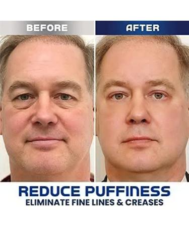 Openeyes Awaken Peptide Lifting Eye Gel Set for Men and Women - Anti-Wrinkle, Firming, Dark Circle Reduction (3PCS) - Buy Online on GoSupps.com