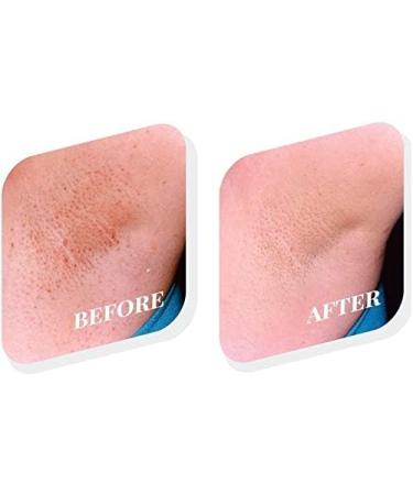 Tend Skin 8 Ounce 2-Pack - Buy Online on GoSupps.com