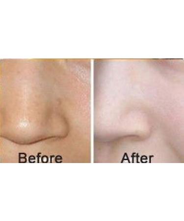 24k Gold Bio-collagen Facial Mask - Luxurious Pack of 5 - Buy Online on GoSupps.com