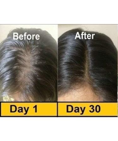 MAGICHOOD Evion Vitamin E Capsule for Face Hair Pimple Glowing Skin Dark Circles Skin Whitening & Control Hair Loss 400 MG (Pack of 8) - Buy Online on GoSupps.com