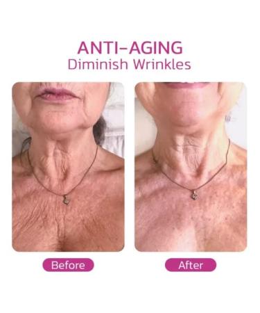 BEROZA 3Pcs REMEDIALX Collagen Firming Neck Cream - Anti-Aging Moisturizer for Skin Tightening & Wrinkle Reduction | Improve Elasticity & Reduce Neck Lines with Neck Firming Formula - Buy Online on GoSupps.com