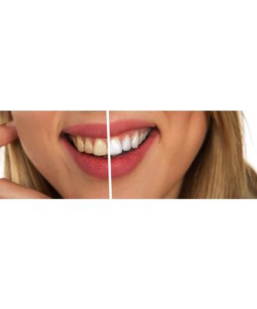 Corsodyl Mint Flavour Mouthwash - Stops and Prevents Bleeding Gums - 600ml - Buy Online on GoSupps.com