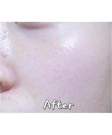 Vegan Beauty Eggplant Daily BHA Moisturizing Cream | Salicylic Acid Anti-Acne Treatment | Natural Moisturizer 1.7 fl. oz - BONAJOUR - Buy Online on GoSupps.com