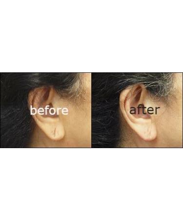 Claires Sunderland - Looks what's back in store Lobe miracle 😊..Instantly  makes torn Lobes, stretched lobes no longer visible #clairesunderland  #clairesstores