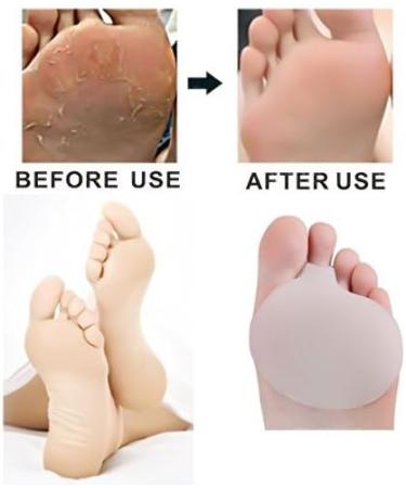 Af-Wan Metatarsal Foot Pads | Gel Ball of Foot Cushions for Pain Relief | 4-Piece Set for Runners | Blister & Callus Prevention - Buy Online on GoSupps.com