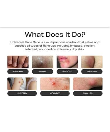 Coco Luxe Body Euphoria DEEP REPAIR CREAM Supports HS-Prone & Sensitive Skin Helps Calm Visible Redness Infused with Neem Oil Allantoin Honey Pollen & Batana Oil 4 oz - Buy Online on GoSupps.com