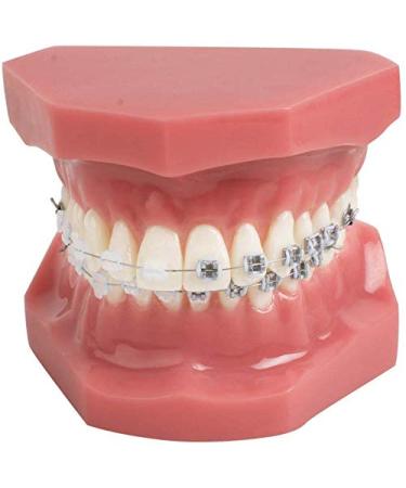 Supports teeth model tipodonto dental with mental brackets orthodontics teeth model treatment with ligature red tie with anti-nail red