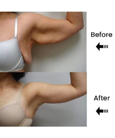 Lymph Node Detox Cream & Ointment Set - Lymphatic Drainage Relief | Pain Relief for Neck & Armpit - 3 Pieces - Buy Online on GoSupps.com