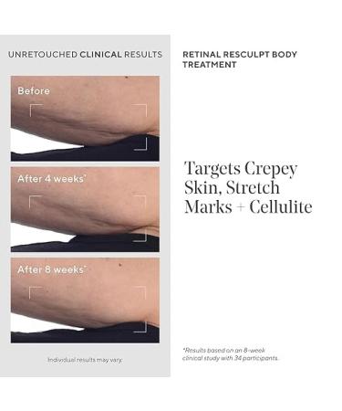 Murad Retinal ReSculpt Body Treatment Encapsulated Retinal Shea & Avocado Extract Body Cream to Firm Lift and Smooth Crepey Sagging Skin Targeting Cellulite and Stretch Marks Nightly 5.0 Fl Oz - Buy Online on GoSupps.com