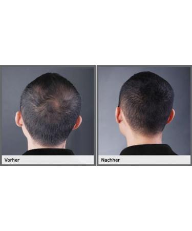 Biothik Hair Building Fiber S7 - Light Blonde 25g | Enhance Your Hair Volume - International Shipping Available - Buy Online on GoSupps.com