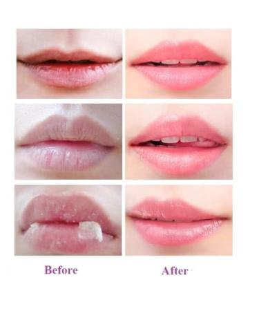 2 Pcs Bee Lip Balm Honey Pot Honey & Strawberry Lip Mask Overnight Moisturizing Scrub Exfoliator Reduces Lip Lines Prevention Dry and Cracked. (Honey & Strawberry) - Buy Online on GoSupps.com